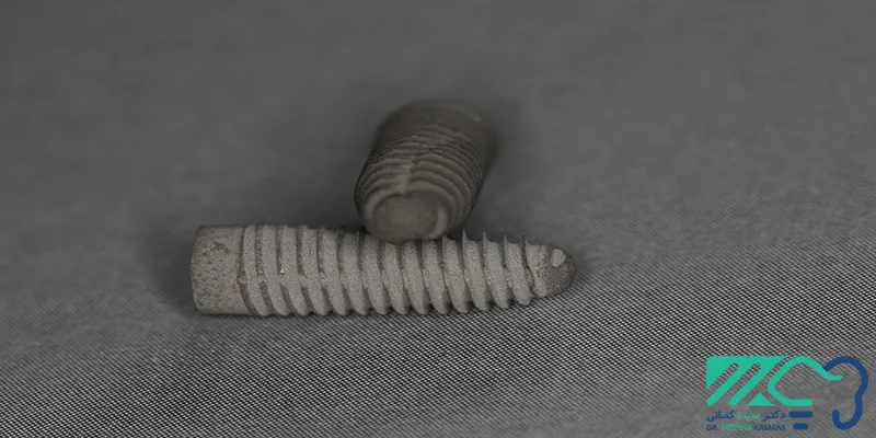 ایمپلنت کره ای 7 ایمپلنت کره ای