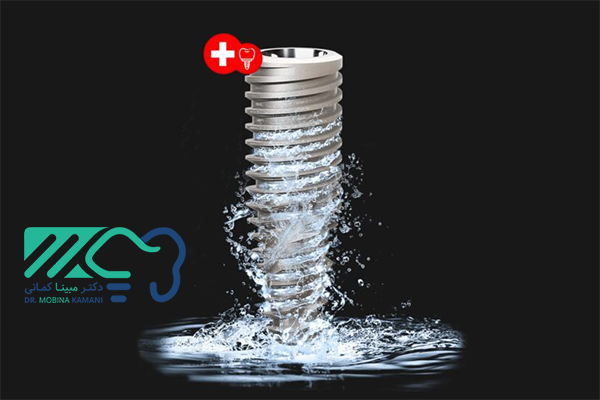 ایمپلنت سوئیسی 10 ایمپلنت سوئیسی در اراک